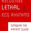 Recognize Lethal ECG Rhythms: Conquer the Patient Clues – Robin Gilbert | Available Now !