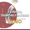 BT93 Clinical Demonstration 17 – Getting Wheels in Motion in Brief Therapy – Stephen Lankton, MSW | Available Now !