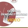 BT10 Clinical Demonstration 06 – Treatment of Worry – Reid Wilson, PhD | Available Now !